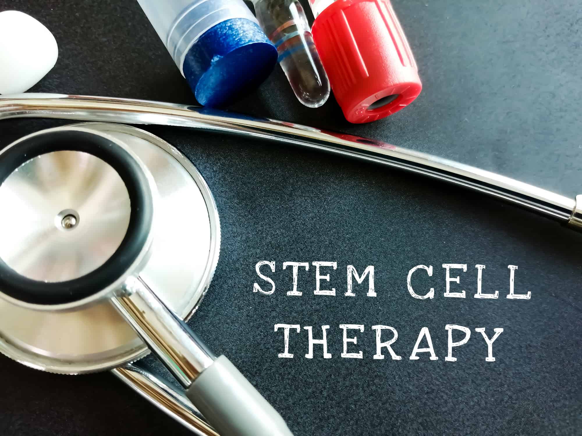 Stem cell therapy medical term on blackboard. stethoscope